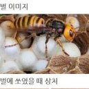 벌에 쏘였을때 증상 대처법 이미지