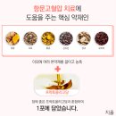 치질, 수술 없이 치료 가능합니다! 이미지