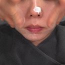 부천메디컬프라자 | 상동피부관리] 겨울철 건조하고 예민한 트러블 피부케어 전문! 부천여드름관리 잘하는 "솔에스테틱 부천점"