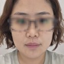 연엔정의료기기 | [평택] 피부관리 전문 샵에서 맞춤형 디자인 하이푸로 탄력 채우고 온 "아이리안" 후기✨