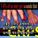 사암침법으로 CRPS 완치 | 정통사암오행침구학회 명의 양성 교육 이미지