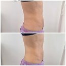 3008호 | [뷰티/인천] 인천피부관리 테라노바 뼈말라 복부관리 찐효과 본 후기 : 커브스 에스테틱