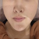 스킨리프 | 하남미사 에스테틱 천연팩케어 [리프온스킨] 후기