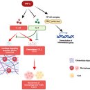 손가락 관절염 이미지