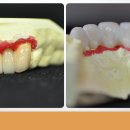다이안치과기공소 이미지