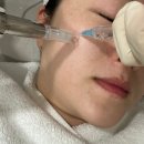 광화문역(5) | 스킨부스터 세렉소(Celexo) 식물 유래 엑소좀 광화문역 피부과 mts 시술 후기