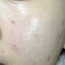 소몽(somong) | 뤼산드 소몽 에센젤 리뷰 : PDRN 에센스 대용량 홈케어 젤 추천