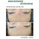 (주)세보에너지 | 평택피부관리 물광피부 1:1키트로 스페셜관리💙