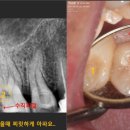 내이처럼기공소 이미지