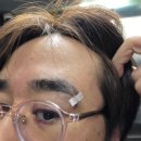 더뺌의원 네이버블로그