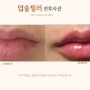 에미뜨의원 이미지