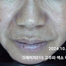 형곡동 기미 톤업 잘하는 피부샵 바르델