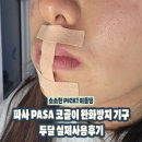 파사 | 코골이방지기구 찾는다면 파사 두달 사용솔직 후기✨ 입벌림방지수면 효과와 불편함까지