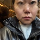 벌포수산 | 강남 윤곽주사 페이스하프컷 한 방에 심부볼, 볼살 정리된 후기!