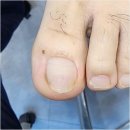 반송동210 | 동탄 반송동 내성발톱 네일포유에서의 전문케어 만족 후기