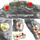 덴치과기공소 이미지