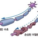 경화 이미지
