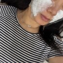 스킨 - 남구 중앙로128번길 36 | 범계피부과 추천, 스킨부스터 쥬베룩스킨 달라진 피부결 후기