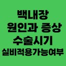 백내장, 언제 수술해야 할까? 시기 판단 체크리스트