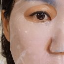 비엔메디 | 피부과앰플 '비엔뷔바이오랩' 메디스파MTS 사용해 본 후기