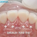 영치과기공소 이미지