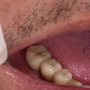 BS치과기공소 이미지