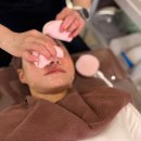 서울 새로운 피부과 의원 | 삼성역 피부과 {얀의원} 온다리프팅 7만 샷 후기 – 주차별 변화 기록 -