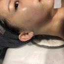 사당피부관리 @더물오름, 20대 모공관리 받고 온 수분케어 찐후기