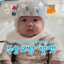 (주)세로 | 사두증 단두증 두상교정 지오헬멧 광교점 후기 (내돈내산)