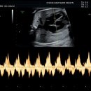 임신 28주 입체초음파 보다 👶 / 청담마리 / 얼굴보기 성공 / 입체초음파 후기 비용 / 2차정밀초음파