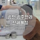 신세계안과의원 | 광주안과 의원 신세계점 스마일라식 가격 통증 한 달경과 후기