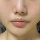 밴스의원 네이버블로그