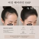 나너울 | 두피(헤어라인) 디자인 관리 후기입니다 📍