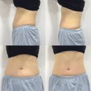 안티에이징 &amp; 안티스트레스 &#34;바르본뷰티&#34; 복부관리 4주 후기 🧖‍♀️