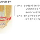 식물 뿌리 양이온 흡수 이미지