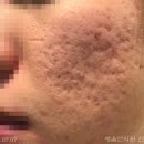 오름한의원 이미지