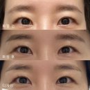 마곡 눈썹 문신 자연스럽게 잘하는 곳, 치유브로우 반영구 자연눈썹 후기