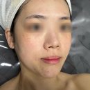 곤케어 | 병점토닝관리 뷰티다해 기미·잡티·색소침착 집중케어 토닝에 미백 수분케어까지 만족한 후기