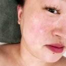 와우로73번길 | 데콜테 피부장벽 무너짐은 봉담피부관리 스킨플러스