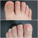 레푸스 앤 두두네일 이미지