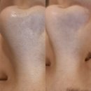 길음역 피부관리 솔직후기 “가인에스테틱 이지다”