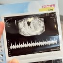 퍼스트약국 | 임신중기영양제 닥터에디션 퍼스트맘2 임산부 철분제 후기