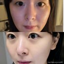 동해 피부관리 추천 테오트리 더수 커플관리 가능한 에스테틱 후기
