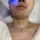 엠제이(MJ)헬스케어 | 엠제이뷰티에서 아이스페셜케어 받은 후기