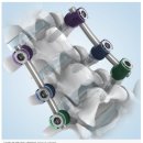 리코메드 이미지