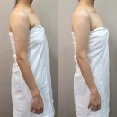수미원 | 웨딩 전 필수코스, 다이어트 림프테라피 솔직후기 [더에스테틱,수미원달서구]
