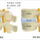 괴정참재활의학과의원 네이버블로그