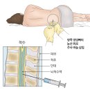 수정종합신발 | 신생아 고열로 건양대병원 1인실 입원 후기