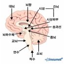 뇌동맥류 증상(뇌동맥꽈리) 이미지