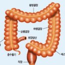 대장 티스토리